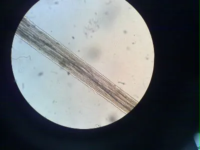 فلوکستین برای چیست