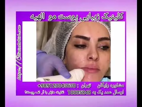 آر اف بهتر است یا هایفو