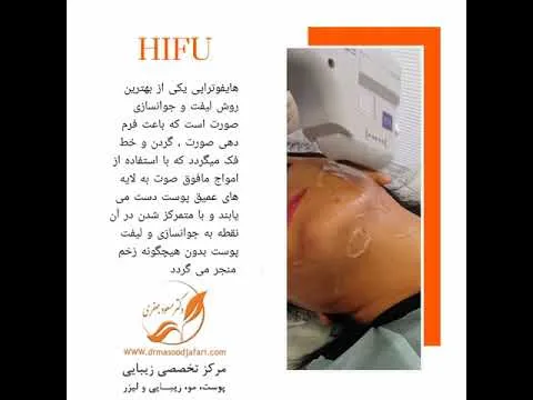 بهترین دکتر هایفو نی نی سایت